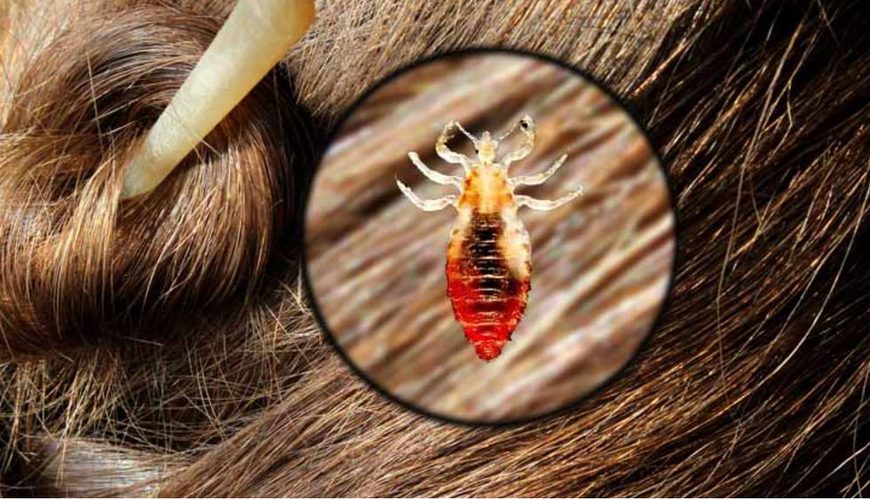 ¿Qué número es soñar con piojos en la cabeza?