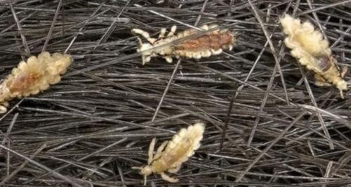 soñar con matar piojo