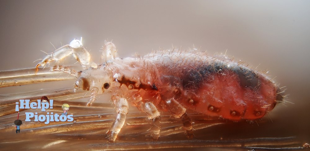 soñar-con-piojos-en-el-pelo-2