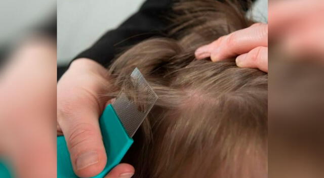 ¿Qué significa cuando sueñas que tu hijo tiene piojos?