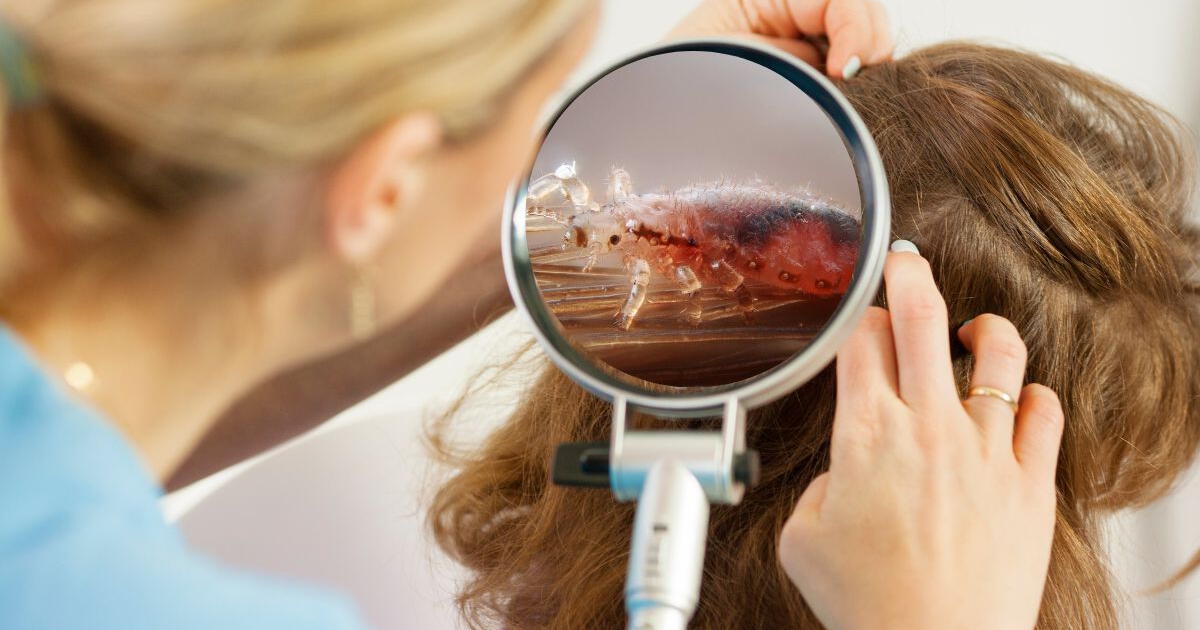 ¿Qué número es soñar con piojos en la cabeza?