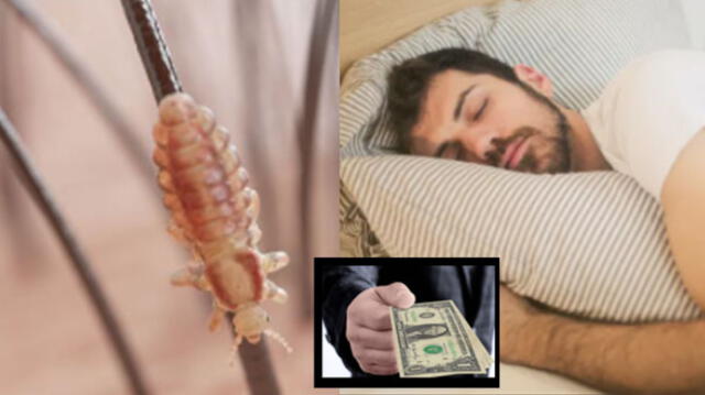 soñar con piojos en la ropa