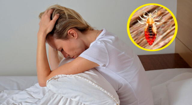 ¿Qué número es soñar con piojos en la cabeza?