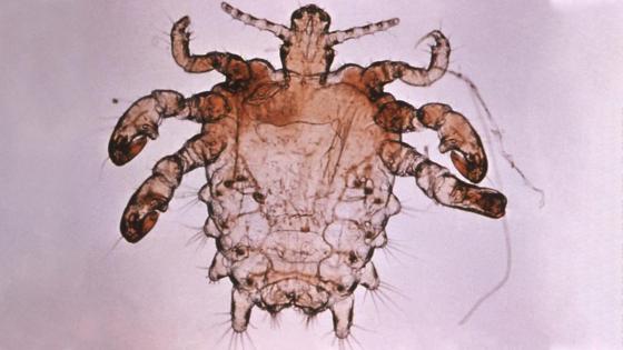 ¿Qué pasa cuando uno se sueña con piojos?