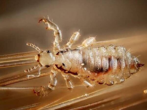 ¿Qué significa soñar con piojos en tu pareja?