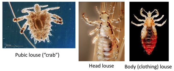 ¿Qué significa soñar con piojos en tu pareja?
