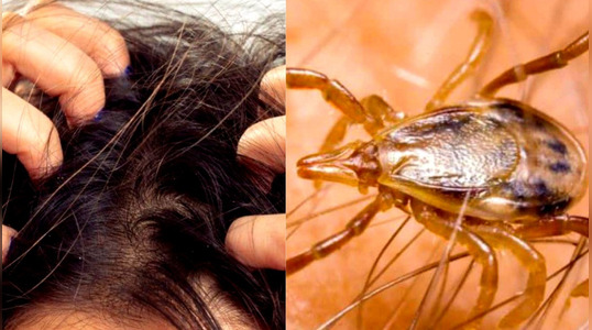 soñar con piojos mi sabueso