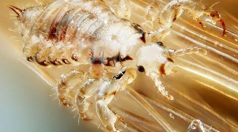 soñar con piojos rubios