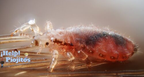 soñar con piojos transparentes