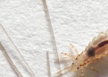 soñar con piojos y matarlos