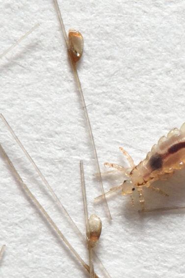 ¿Qué significado tiene soñar con pulgas y piojos?