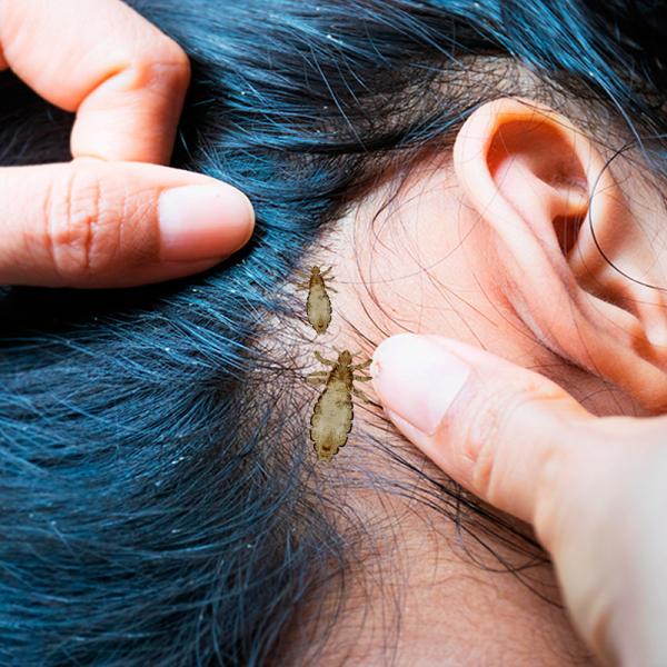 ¿Qué número se juega soñar con piojos?