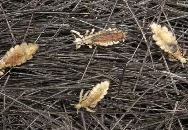 ¿Qué número se juega soñar con piojos?